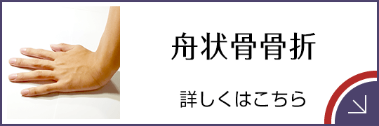 舟状骨骨折